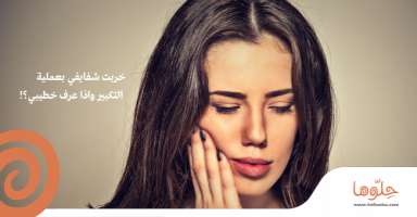 كبرت شفايفي من دون علم خطيبي